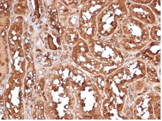 MICA Antibody in Immunohistochemistry (Paraffin) (IHC (P))