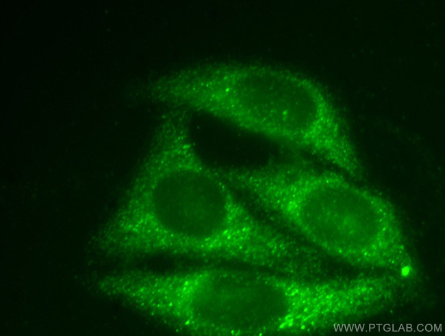 SNAPIN Antibody in Immunocytochemistry (ICC/IF)