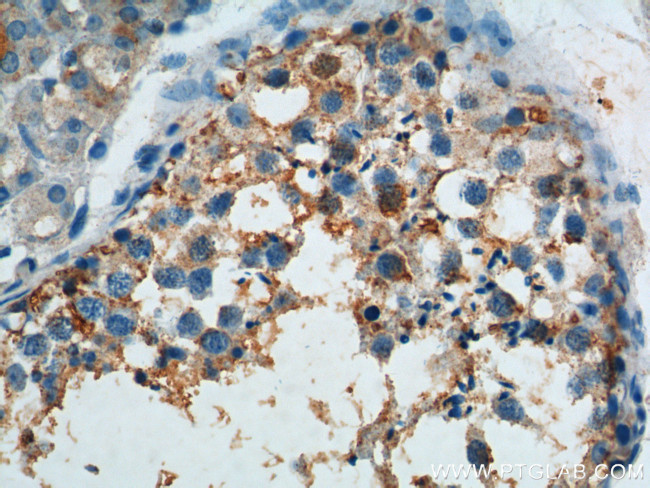 SNAPIN Antibody in Immunohistochemistry (Paraffin) (IHC (P))