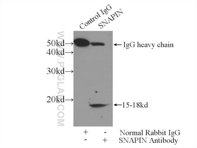 SNAPIN Antibody in Immunoprecipitation (IP)