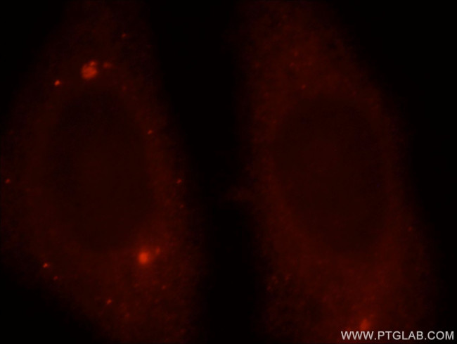 SNAPIN Antibody in Immunocytochemistry (ICC/IF)