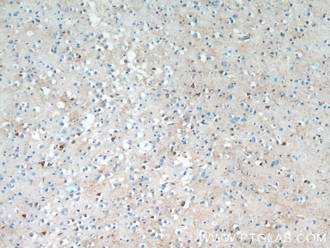 SNAPIN Antibody in Immunohistochemistry (Paraffin) (IHC (P))