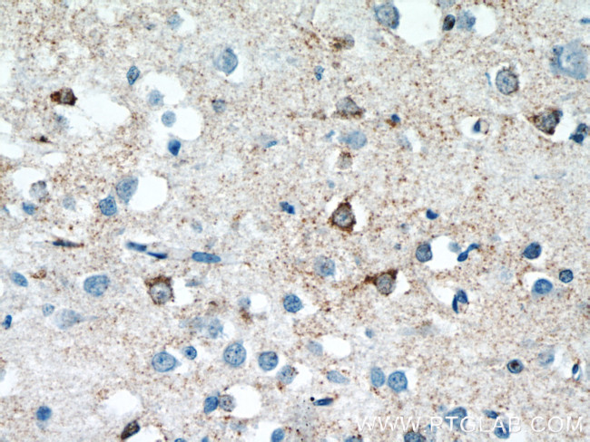 SNAPIN Antibody in Immunohistochemistry (Paraffin) (IHC (P))