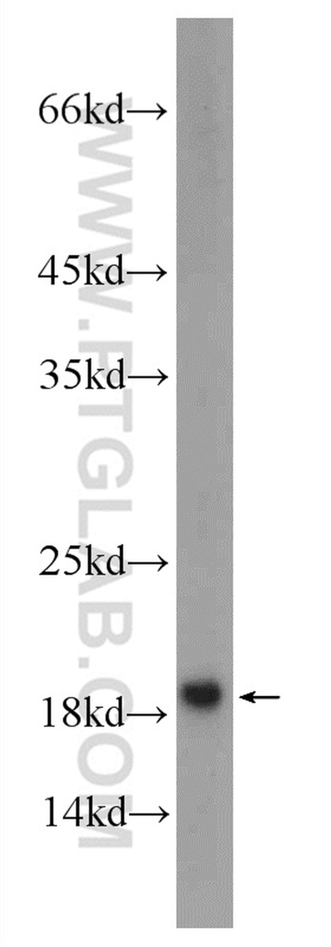 SNAPIN Antibody in Western Blot (WB)