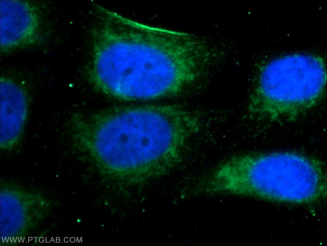 MEF2C Antibody in Immunocytochemistry (ICC/IF)