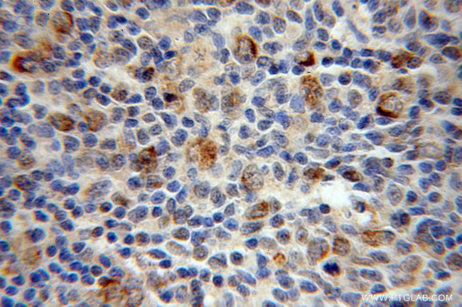 MEF2C Antibody in Immunohistochemistry (Paraffin) (IHC (P))