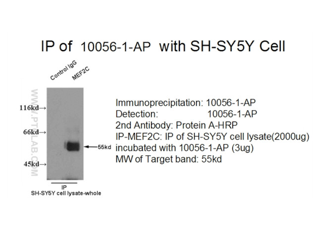 MEF2C Antibody in Immunoprecipitation (IP)