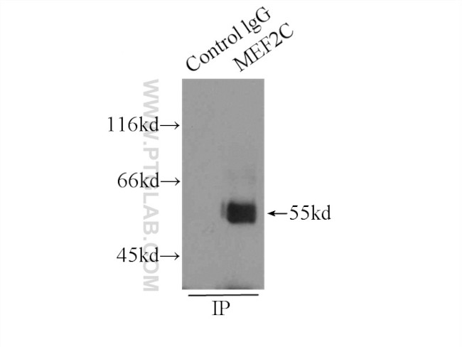 MEF2C Antibody in Immunoprecipitation (IP)