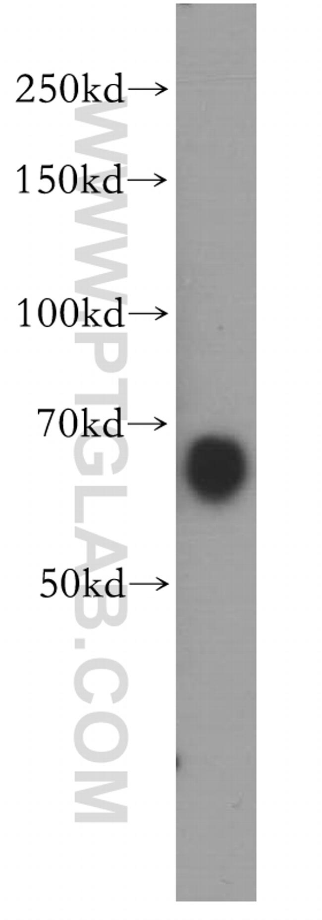 MEF2C Antibody in Western Blot (WB)