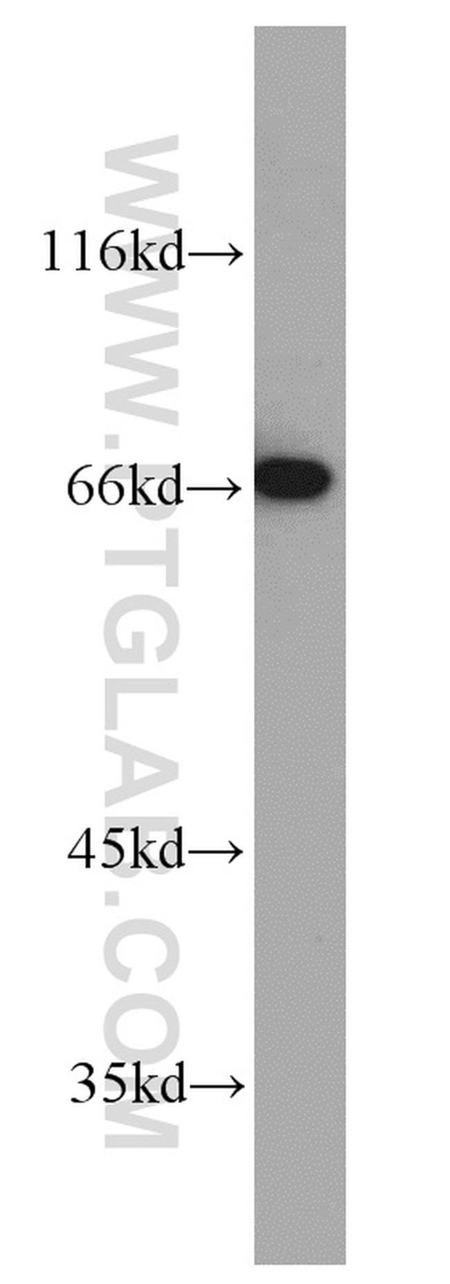 MEF2C Antibody in Western Blot (WB)