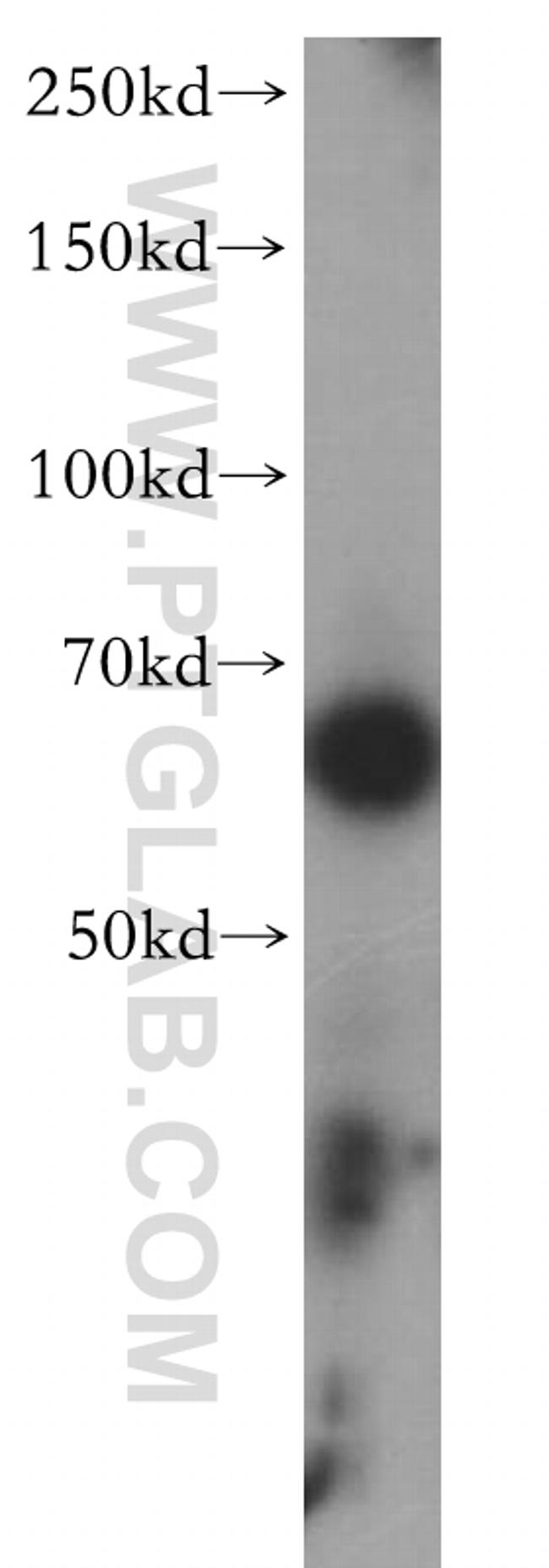 MEF2C Antibody in Western Blot (WB)