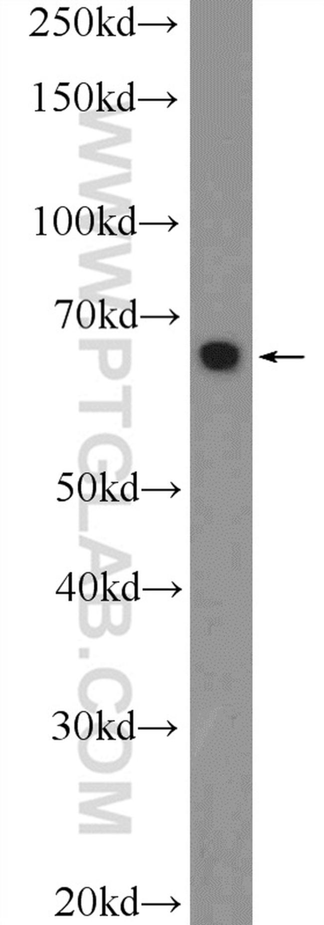 MEF2C Antibody in Western Blot (WB)