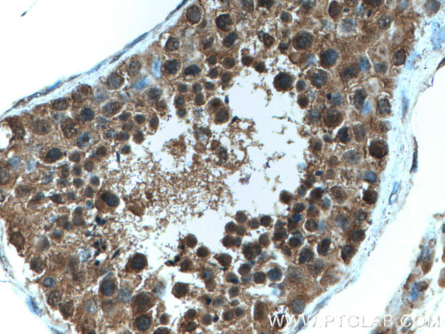 FKBPL Antibody in Immunohistochemistry (Paraffin) (IHC (P))