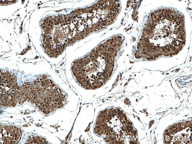 FKBPL Antibody in Immunohistochemistry (Paraffin) (IHC (P))