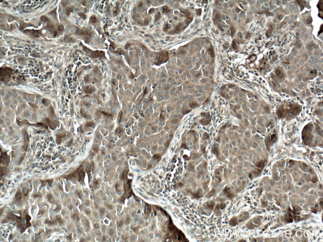 FKBPL Antibody in Immunohistochemistry (Paraffin) (IHC (P))