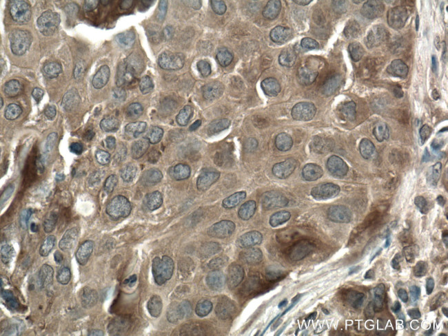 FKBPL Antibody in Immunohistochemistry (Paraffin) (IHC (P))