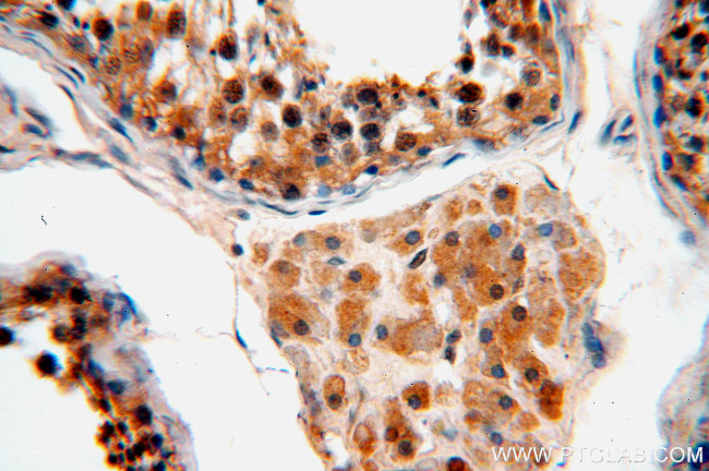 FKBPL Antibody in Immunohistochemistry (Paraffin) (IHC (P))