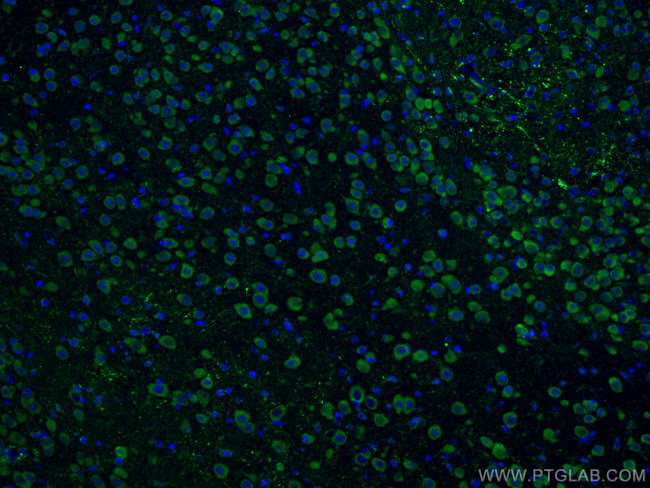 Notch1 Antibody in Immunohistochemistry (Paraffin) (IHC (P))