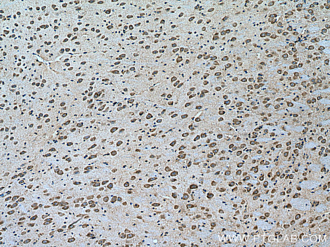 Notch1 Antibody in Immunohistochemistry (Paraffin) (IHC (P))