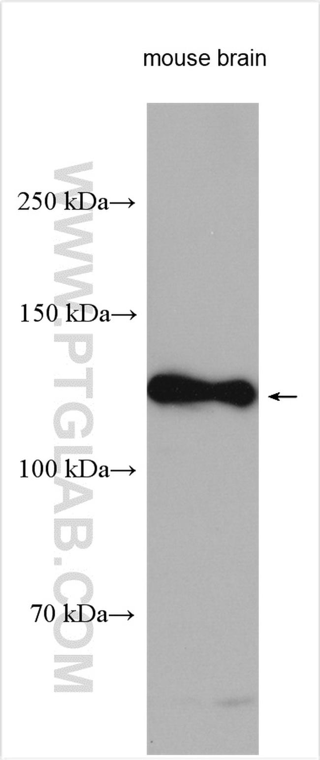 Notch1 Antibody in Western Blot (WB)