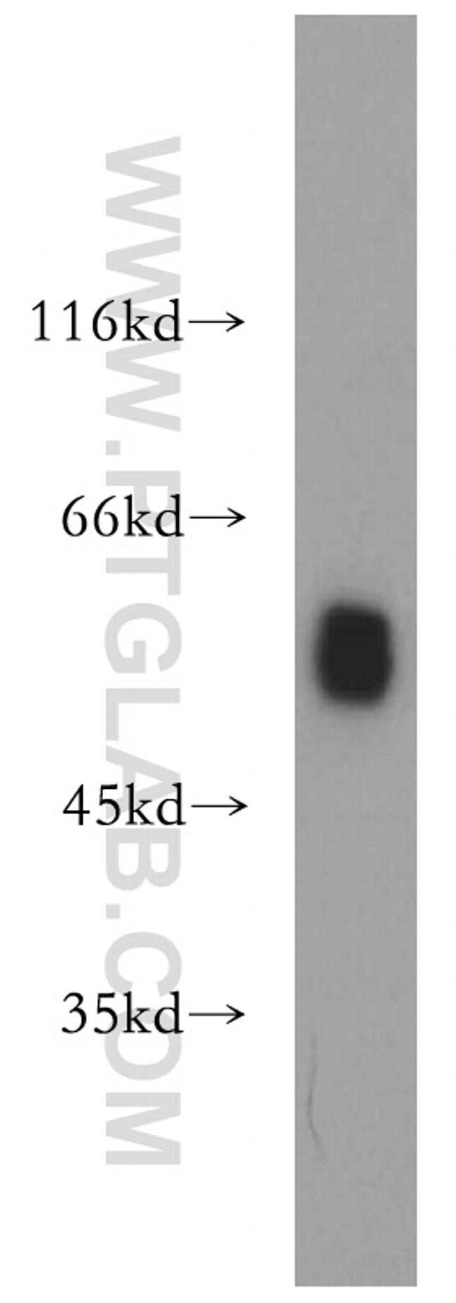 CSTF1 Antibody in Western Blot (WB)