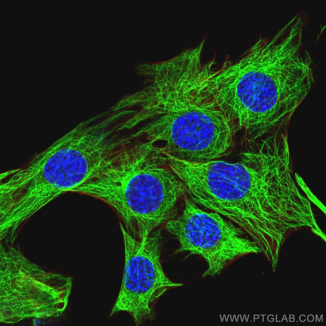 beta Tubulin Antibody in Immunocytochemistry (ICC/IF)