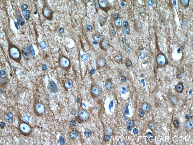 beta Tubulin Antibody in Immunohistochemistry (Paraffin) (IHC (P))