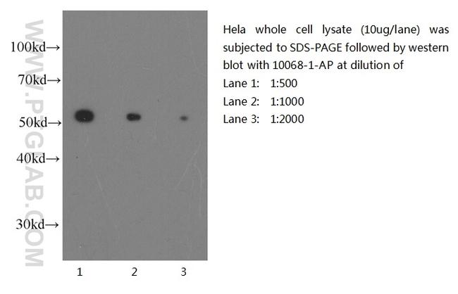 beta Tubulin Antibody in Western Blot (WB)