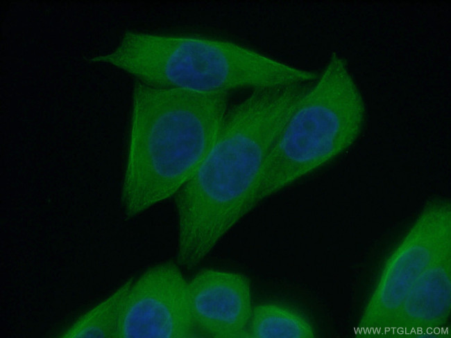 beta Tubulin Antibody in Immunocytochemistry (ICC/IF)