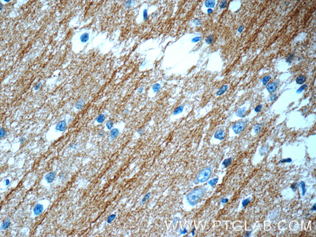 beta Tubulin Antibody in Immunohistochemistry (Paraffin) (IHC (P))