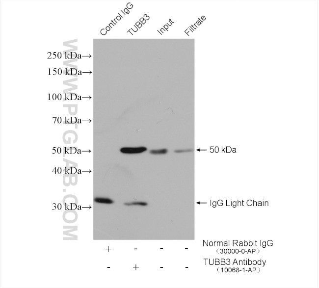 beta Tubulin Antibody in Immunoprecipitation (IP)