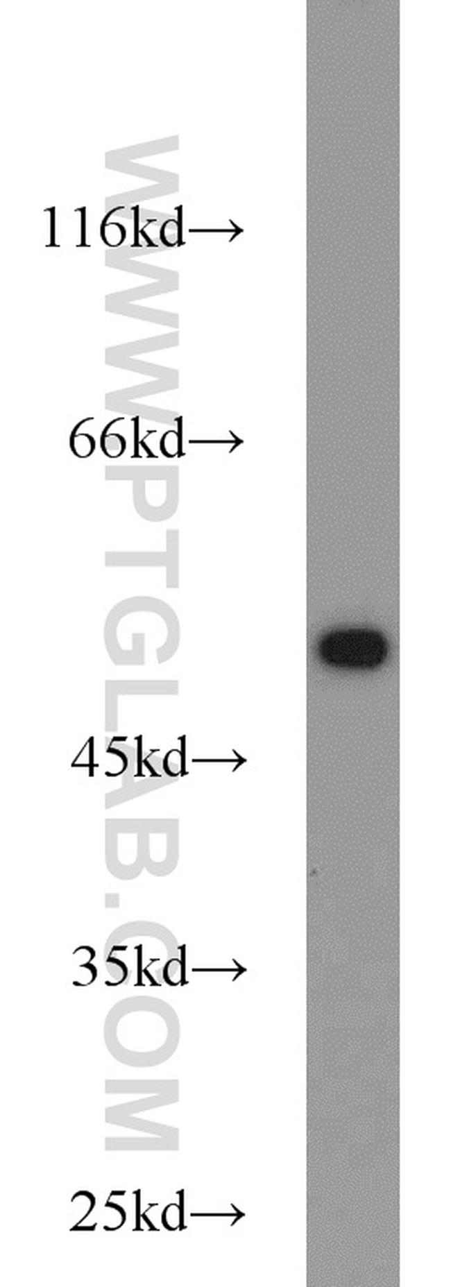 beta Tubulin Antibody in Western Blot (WB)