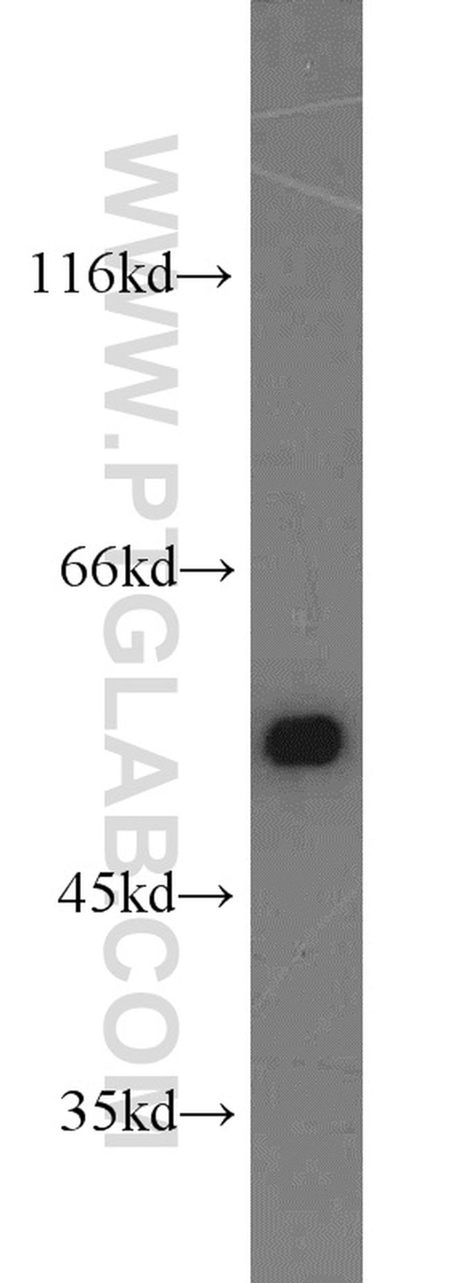 beta Tubulin Antibody in Western Blot (WB)