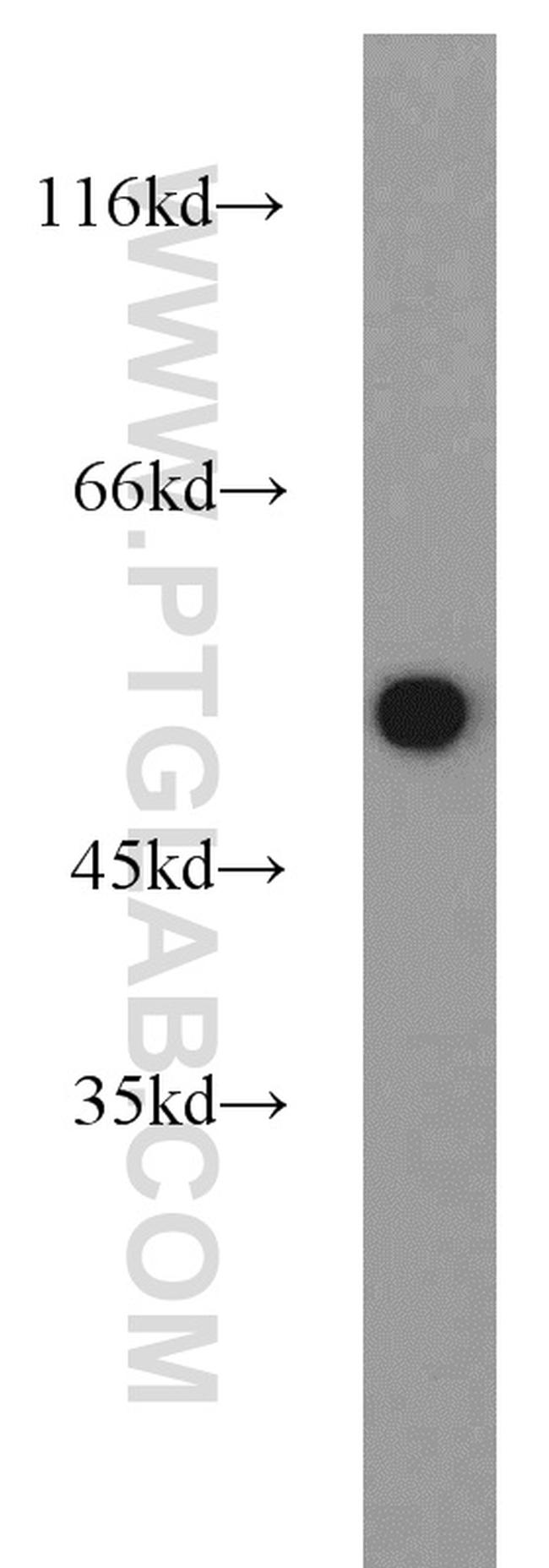 beta Tubulin Antibody in Western Blot (WB)