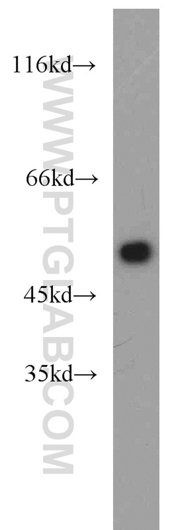 beta Tubulin Antibody in Western Blot (WB)