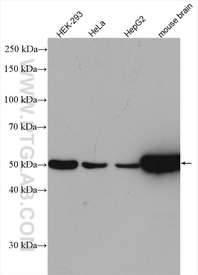 beta Tubulin Antibody in Western Blot (WB)