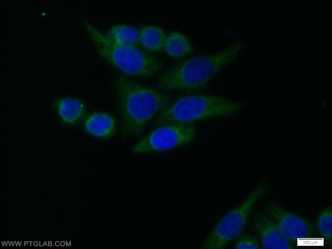 RB1CC1 Antibody in Immunocytochemistry (ICC/IF)