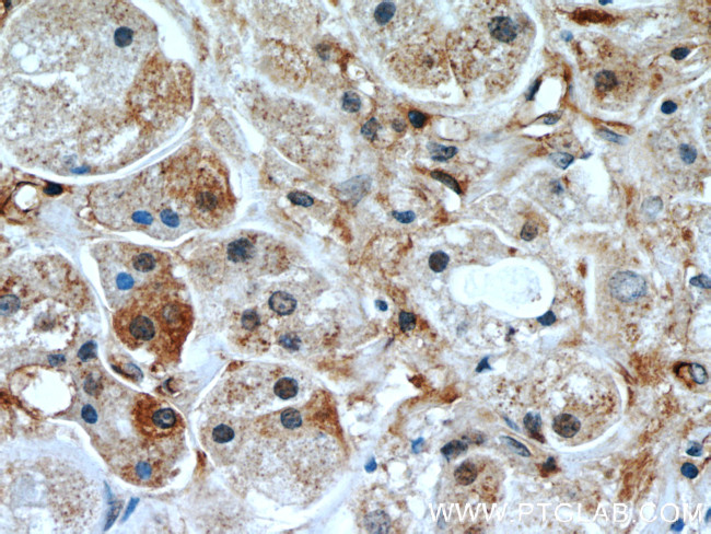 RB1CC1 Antibody in Immunohistochemistry (Paraffin) (IHC (P))