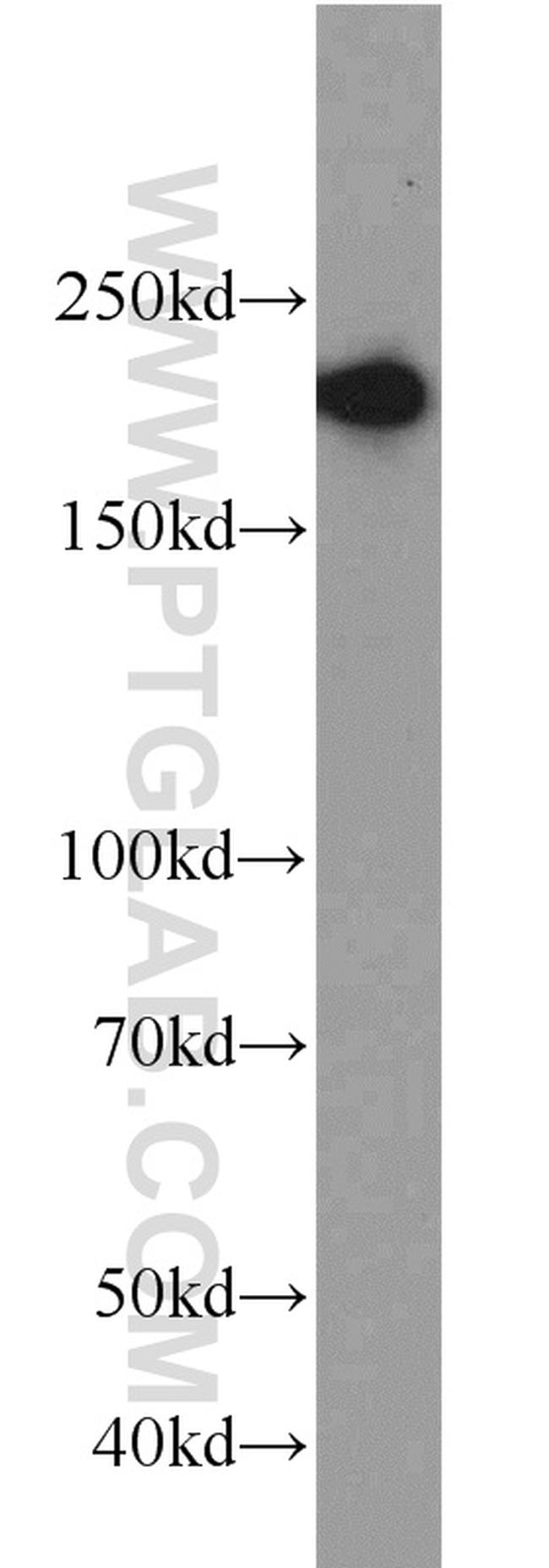 RB1CC1 Antibody in Western Blot (WB)