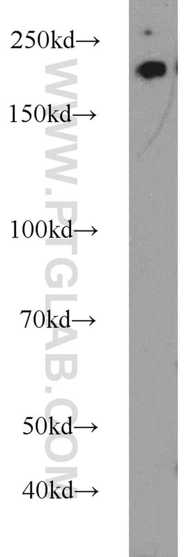 RB1CC1 Antibody in Western Blot (WB)