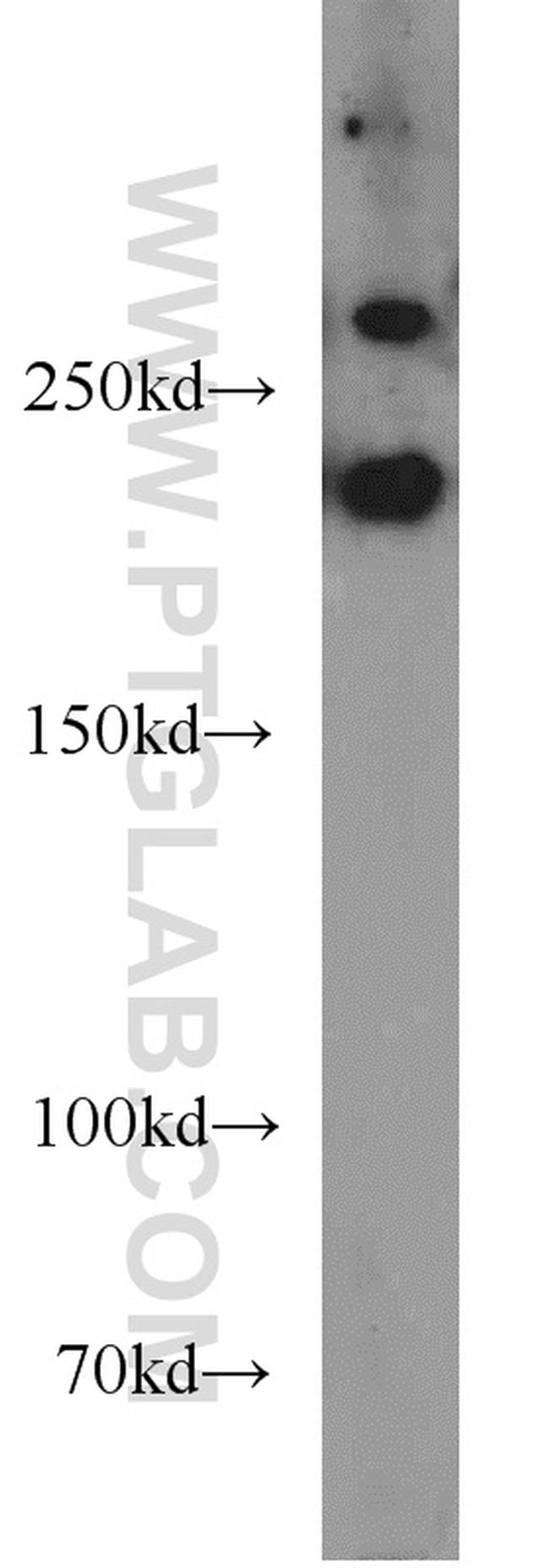 RB1CC1 Antibody in Western Blot (WB)