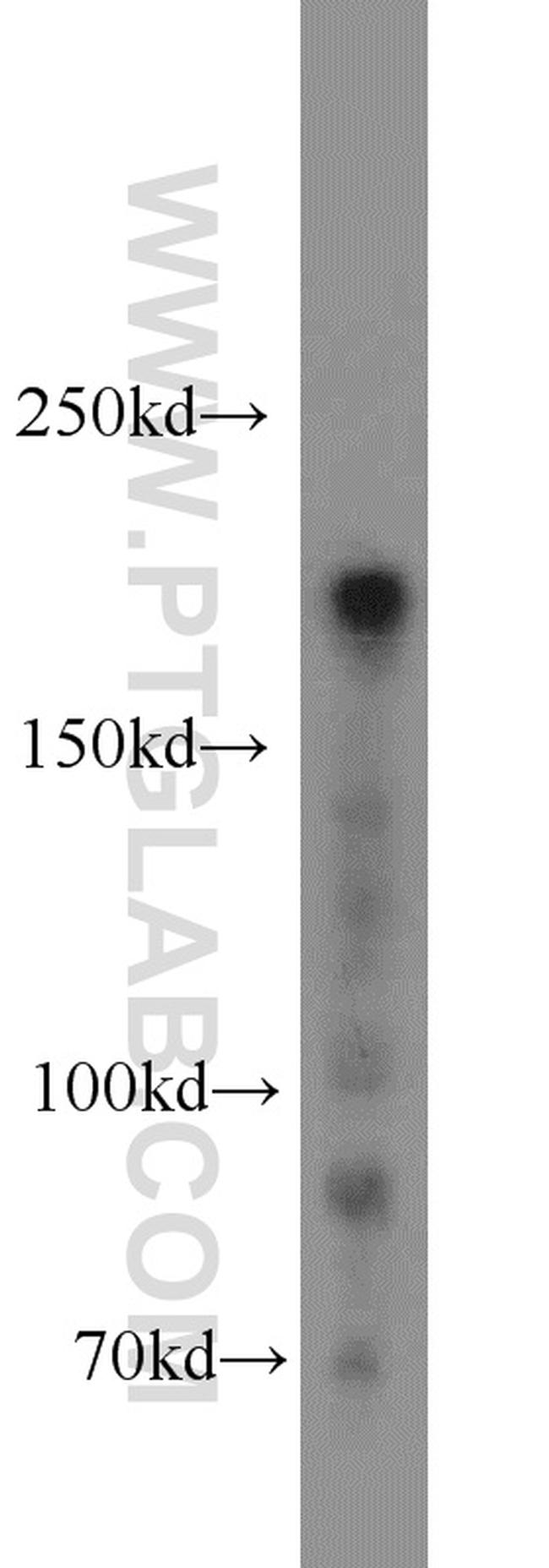 RB1CC1 Antibody in Western Blot (WB)