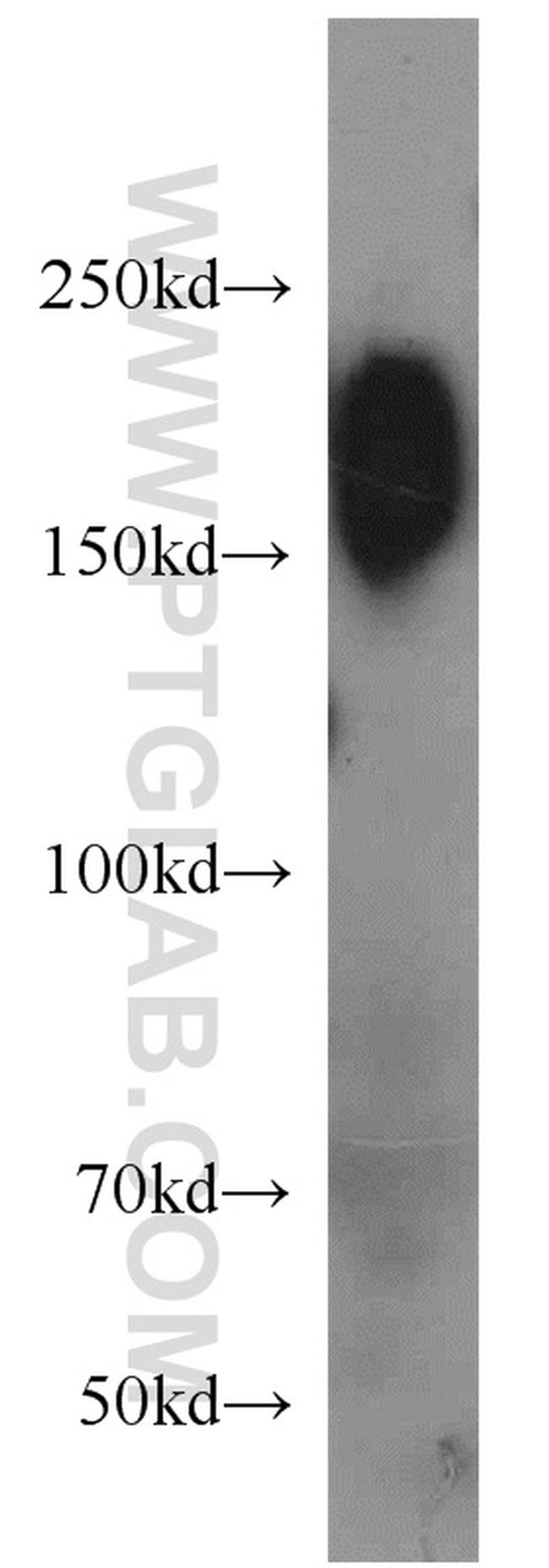 RB1CC1 Antibody in Western Blot (WB)