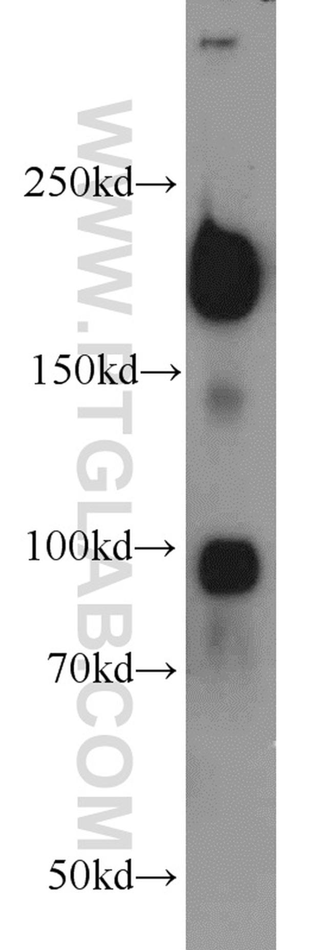 RB1CC1 Antibody in Western Blot (WB)