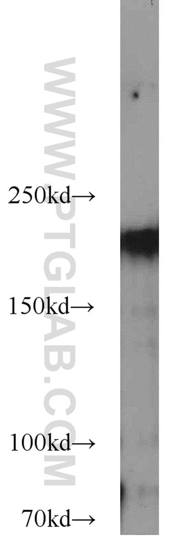 RB1CC1 Antibody in Western Blot (WB)