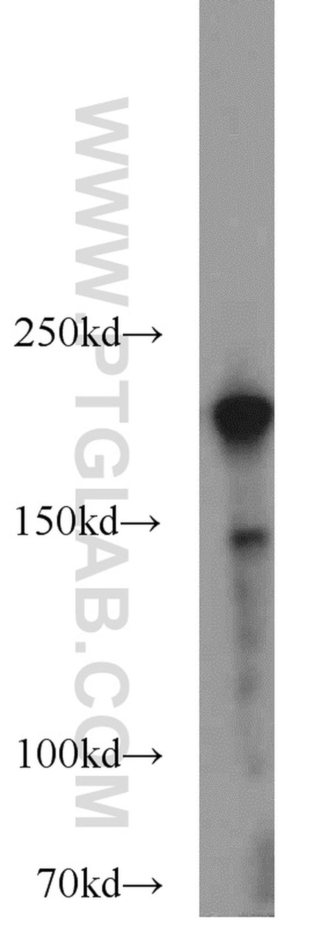 RB1CC1 Antibody in Western Blot (WB)