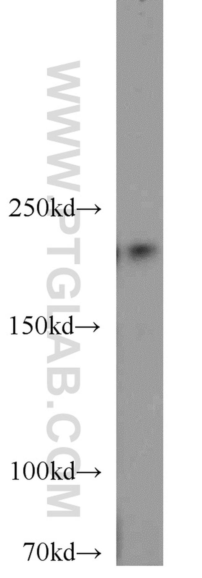 RB1CC1 Antibody in Western Blot (WB)