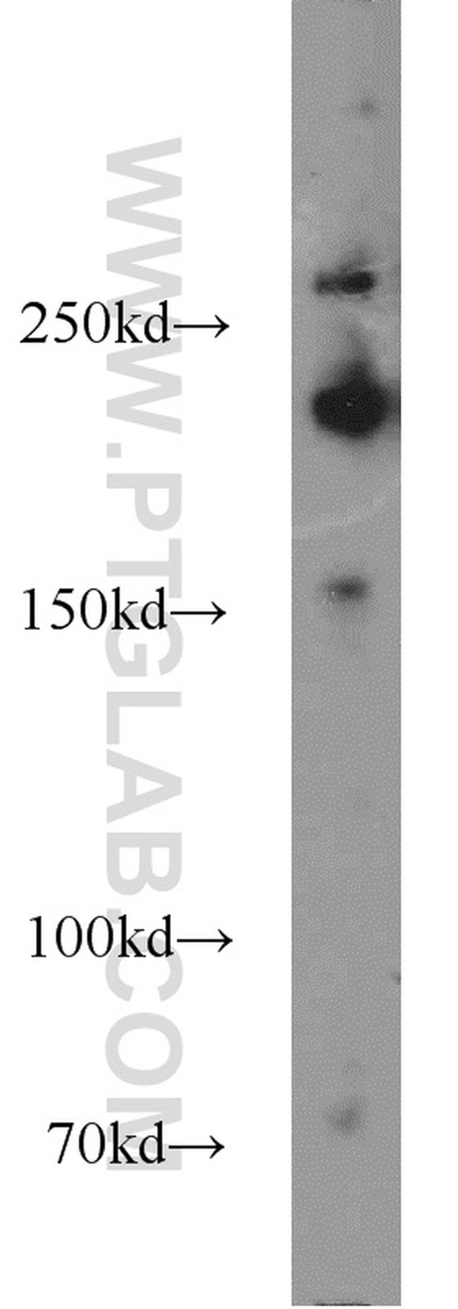 RB1CC1 Antibody in Western Blot (WB)