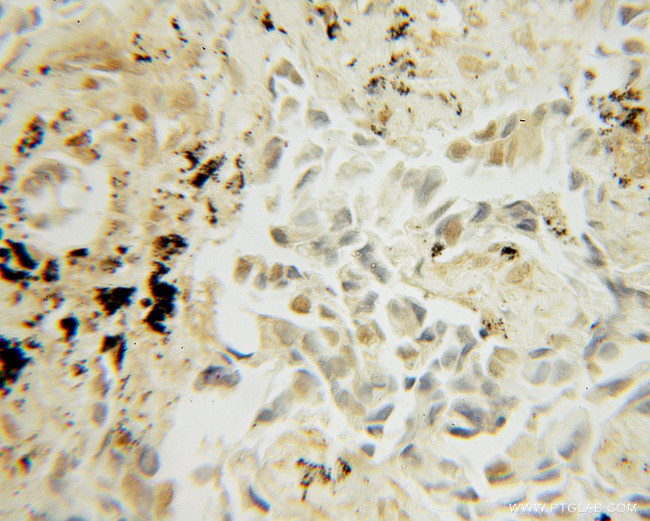 UBC9 Antibody in Immunohistochemistry (Paraffin) (IHC (P))