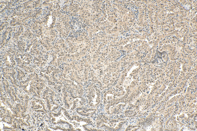 UBC9 Antibody in Immunohistochemistry (Paraffin) (IHC (P))